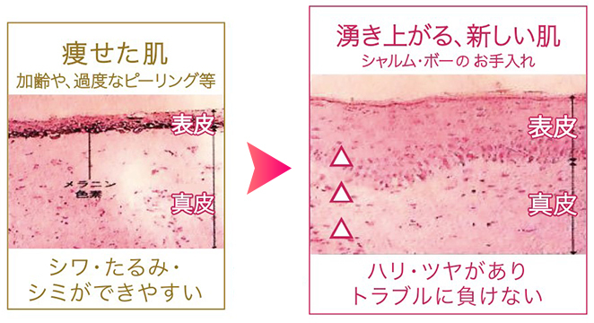 シミ・シワ・たるみができやすい痩せた肌とハリつやのある肌のイメージ