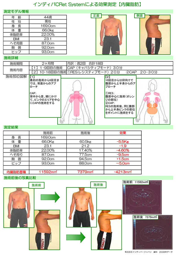 インディバボディCRet System 施術前と施術後の比較データ