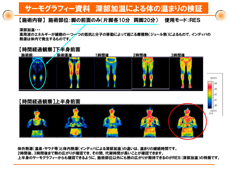 インディバボディ痩身マサージ時の下半身・上半身の体の温まりの検証資料