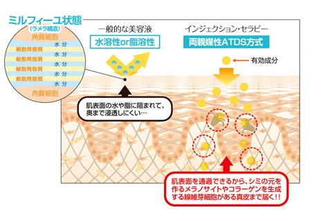 インジェクションセラピーとは？