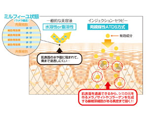 横並び左画像